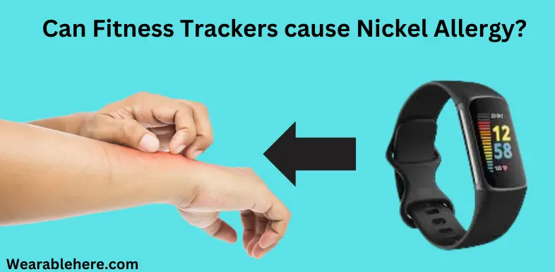 can fitness tracker causes nickel allergy